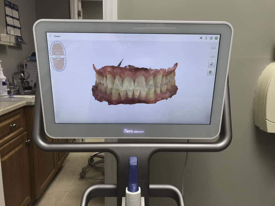 Cutting-edge iTero scanner for precise digital impressions and treatment planning.