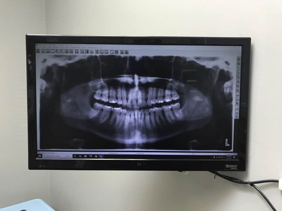 Wide-view dental X-ray