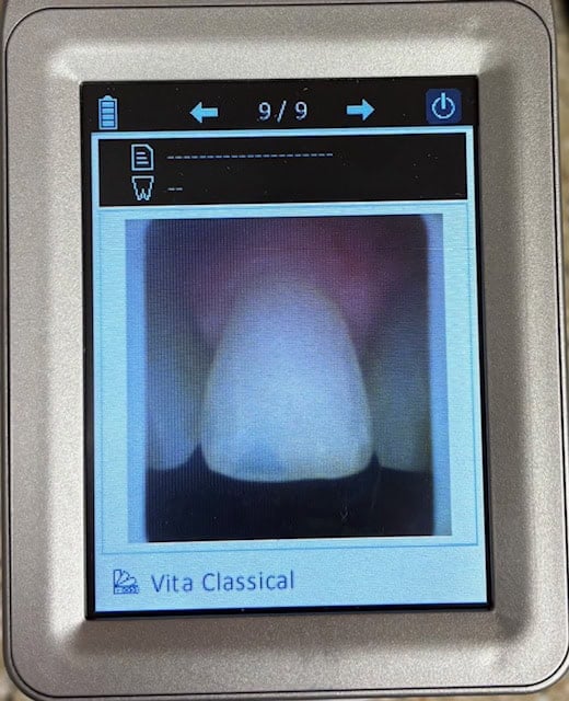 Our advanced shade-matching technology