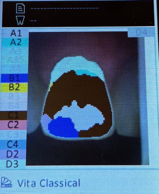 Digital Shade Mapping