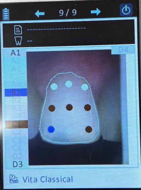 Shade Analysis Points