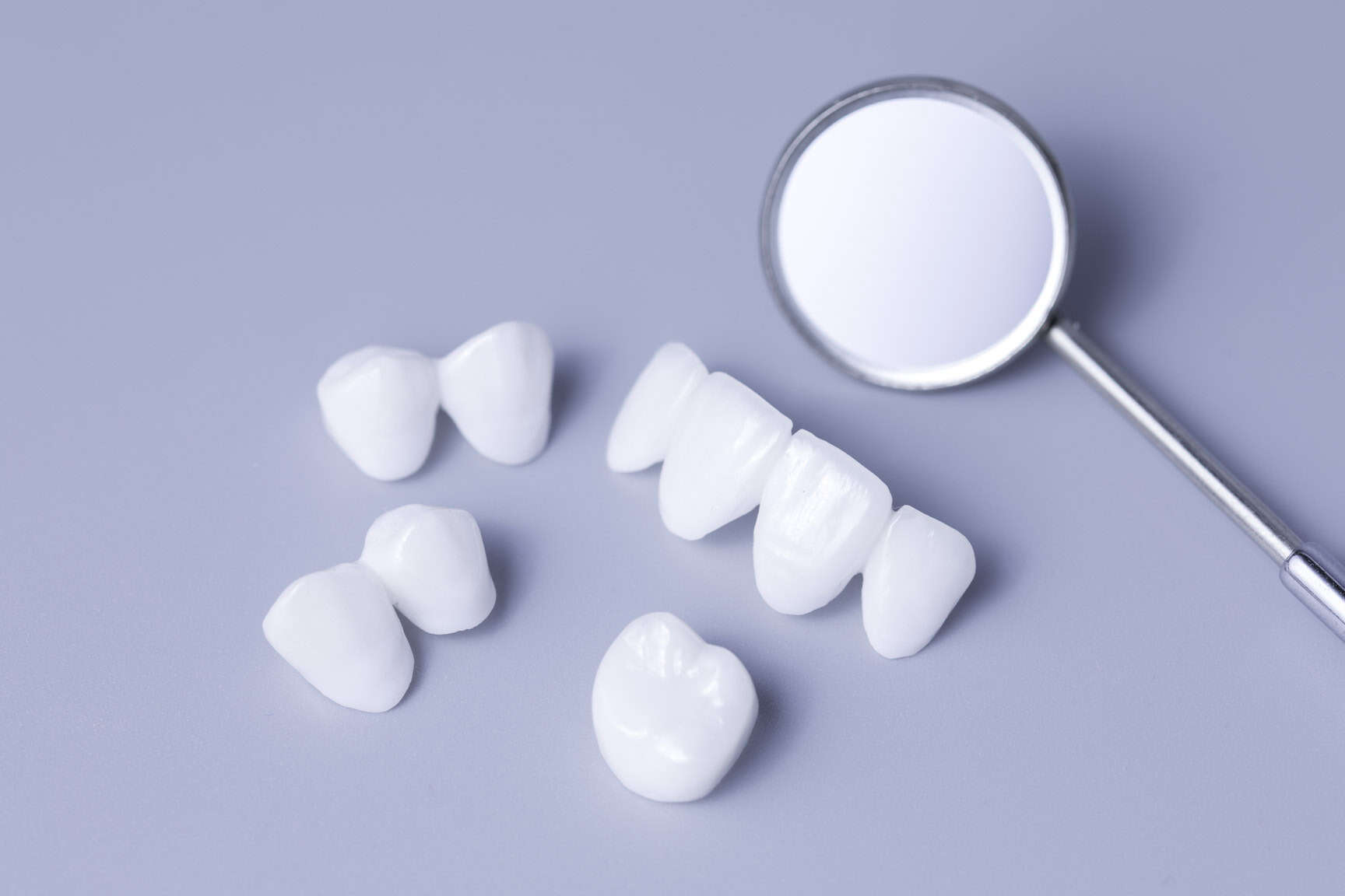 Veneers